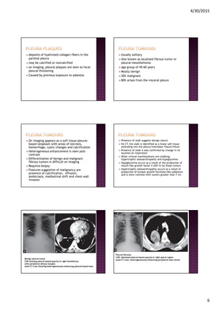 4/30/2015
6
deposits of hyalinized collagen fibers in the
parietal pleura
may be calcified or noncalcified
on imaging, pleural plaques are seen as focal
pleural thickening
Caused by previous exposure to asbestos
Usually solitary
Also known as localized fibrous tumor or
pleural mesothelioma
age group of 45-60 years
Mostly benign
20% malignant
80% arises from the visceral pleura
On imaging appears as a soft tissue pleural-
based neoplasm with areas of necrosis,
hemorrhage, cystic changes and calcification
Heterogeneous enhancement is seen post-
contrast
Differentiation of benign and malignant
fibrous tumors is difficult on imaging
Requires biopsy
Features suggestive of malignancy are
presence of calcification, effusion,
atelectasis, mediastinal shift and chest wall
invasion
Presence of stalk suggests benign nature
On CT, the stalk is identified as a linear soft tissue
extending into the pleura/interlobar fissure/hilum
Presence of stalk is also confirmed by change in its
location on respiration
Other clinical manifestations are clubbing,
hypertrophic osteoarthropathy and hypoglycemia
Hypoglycemia occurs as a result of the production of
insulin-like growth factor II (IGF-II) by these tumors
Hypertrophic osteoarthropathy occurs as a result of
production of ectopic growth hormone-like substance
and is more common with tumors greater than 7 cm
Benign pleural tumor
CXR showing pleural-based opacity in right hemithorax
with peripheral obtuse margins
Axial CT scan showing heterogeneously enhancing pleural-based mass
Pleural fibroma
CXR: lobulated pleural-based opacity in right apical region
Axial CT scan: heterogeneously enhancing peripheral mass lesion
 