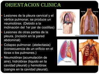 ORIENTACION CLINICA
 Lesiones de la pleura cervical y el
  vértice pulmonar, se produce un
  neumotórax. (Debido a la
  inclinación del 1er par de costillas)
 Lesiones de otras partes de la
  pleura. (incisión en la pared
  abdominal)
 Colapso pulmonar. (atelectasia)
  (consecuencia de un orificio en el
  tórax o los pulmones.)
 Neumotórax (acumulación de
  aire), hidrotórax (liquido en la
  cavidad pleural) y hemotórax
  (sangre en la cavidad pleural).
 