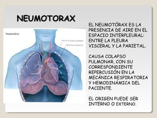 EL NEUMOTÓRAX ES LA
PRESENCIA DE AIRE EN EL
ESPACIO INTERPLEURAL:
ENTRE LA PLEURA
VISCERAL Y LA PARIETAL.
CAUSA COLAPSO
PULMONAR, CON SU
CORRESPONDIENTE
REPERCUSIÓN EN LA
MECÁNICA RESPIRATORIA
Y HEMODINÁMICA DEL
PACIENTE.
EL ORIGEN PUEDE SER
INTERNO O EXTERNO.
 
