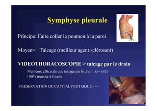 Pleuresie neoplasique metastatique - Metastatic pleural effusions ...