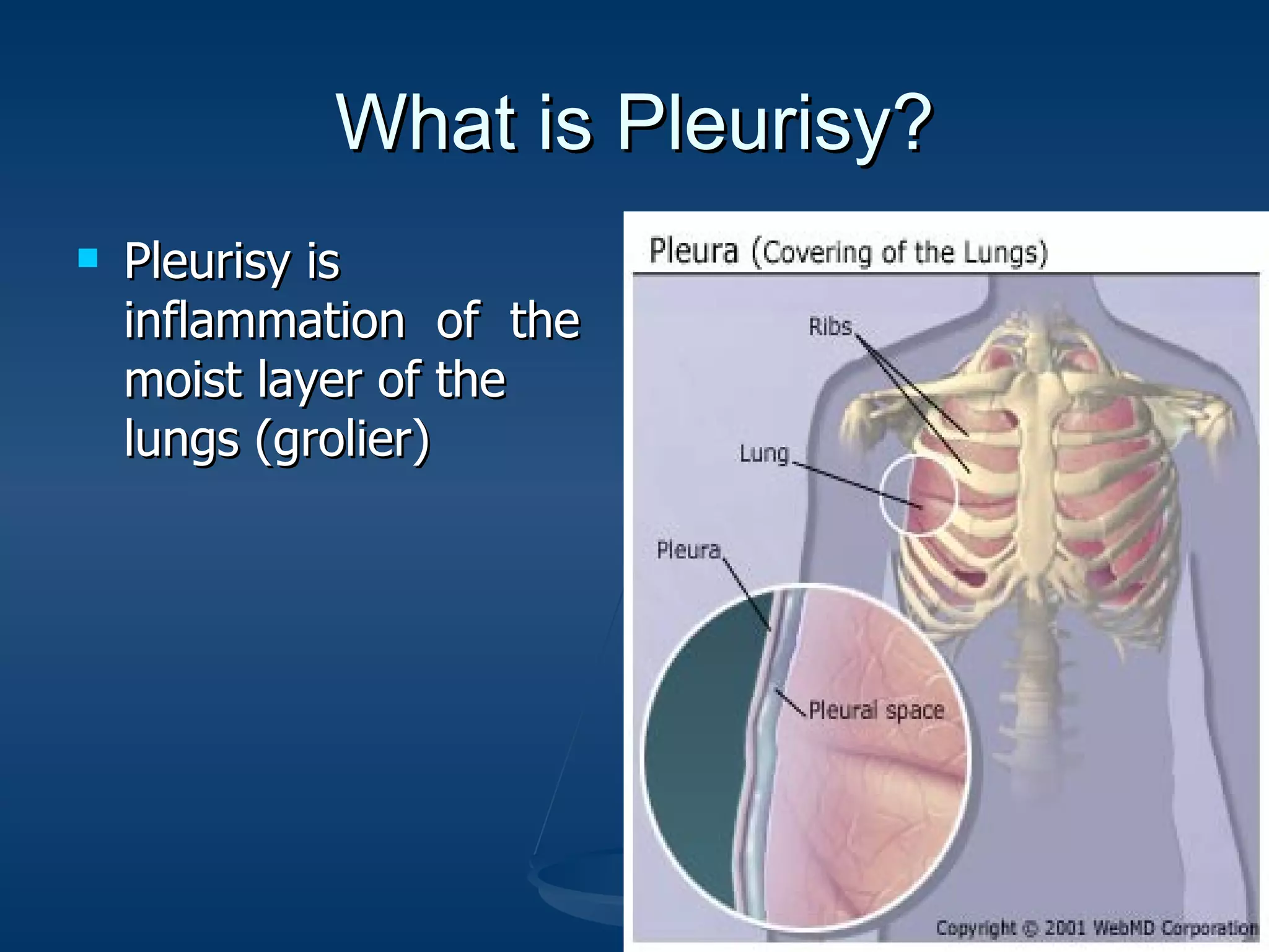 What is Pleurisy? Pleurisy is inflammation of the moist layer of the lungs (grolier)