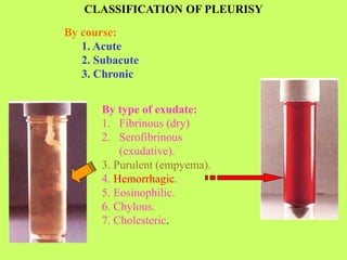 CLASSIFICATION OF PLEURISY
By course:
1. Acute
2. Subacute
3. Chronic
By type of exudate:
1. Fibrinous (dry)
2. Serofibrinous
(exudative).
3. Purulent (empyema).
4. Hemorrhagic.
5. Eosinophilic.
6. Chylous.
7. Cholesteric.
 