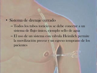 • Sistema de drenaje cerrado
  – Todos los tubos torácicos se debe conectar a un
    sistema de flujo único, ejemplo sello de agua
  – El uso de un sistema con válvula Heimlich permite
    la movilización precoz y un egreso temprano de los
    pacientes
 