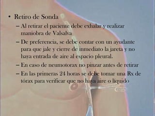 • Retiro de Sonda
  – Al retirar el paciente debe exhalar y realizar
    maniobra de Valsalva
  – De preferencia, se debe contar con un ayudante
    para que jale y cierre de inmediato la jareta y no
    haya entrada de aire al espacio pleural.
  – En caso de neumotorax no pinzar antes de retirar
  – En las primeras 24 horas se debe tomar una Rx de
    tórax para verificar que no haya aire o líquido
 