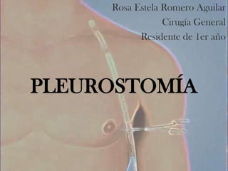 Rosa Estela Romero Aguilar
                 Cirugía General
           Residente de 1er año




PLEUROSTOMÍA
 