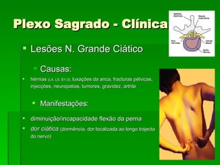 Plexo Sagrado - Clínica Lesões N. Grande Ciático Causas: hérnias  (L4, L5; S1-3),  luxações da anca, fracturas pélvicas, injecções, neuropatias, tumores, gravidez, artrite Manifestações: diminuição/incapacidade flexão da perna dor ciática   (dormência, dor localizada ao longo trajecto do nervo) 