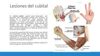 Lesiones del cubital
El nervio cubital puede verse lesionado por
fracturas del epicóndilo medial del húmero, la
flexión de la articulación radio carpiana está
limitada y la mano se puede presentar con
extensión en dicha articulación y en las de las
falanges proximales de los dedos acompañado con
flexión de las falanges media y distal
fundamentalmente del 4to y 5to dedos en semi
garra (mano predicador), se observa atrofia de los
músculos de la región.
La posición superficial del nervio al pasar por detrás
del epicóndilo medial del húmero hace que con
cierta frecuencia, al apoyar los codos sobre ese
epicóndilo o al recibir un golpe en la región, se
produzca una sensación de calambre que se irradia
hacia su territorio de inervación.
La lesión de los nervio cubital y mediano originan la
mano en garra o mano de simio.
 