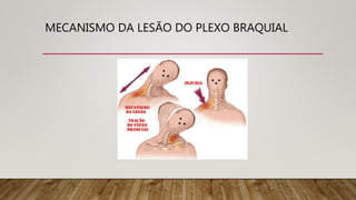 SINTOMAS DAS LESÕES DO PLEXO BRAQUIAL
• Dor
• Fraqueza do Braço
• Redução dos reflexos
• Atrofias
• Paralisia de Erb Duchenne e paralisia de Klumpke (obstetricas)