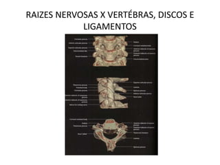 RAIZES NERVOSAS X VERTÉBRAS, DISCOS E
LIGAMENTOS
 