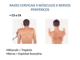 RAIZES CERVICAIS X MÚSCULOS X NERVOS
PERIFÉRICOS
• C3 e C4
•Músculo = Trapézio
•Nervo = Espinhal Acessório
 