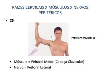 • C5
• Músculo = Peitoral Maior (Cabeça Clavicular)
• Nervo = Peitoral Lateral
RAIZES CERVICAIS X MÚSCULOS X NERVOS
PERIFÉRICOS
PARTICIPA TAMBÉM C6
 