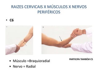 • C6
• Músculo =Braquioradial
• Nervo = Radial
RAIZES CERVICAIS X MÚSCULOS X NERVOS
PERIFÉRICOS
PARTICIPA TAMBÉM C5
 