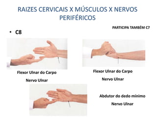 • C8
Flexor Ulnar do Carpo
Nervo Ulnar
Flexor Ulnar do Carpo
Nervo Ulnar
RAIZES CERVICAIS X MÚSCULOS X NERVOS
PERIFÉRICOS
PARTICIPA TAMBÉM C7
Abdutor do dedo mínimo
Nervo Ulnar
 