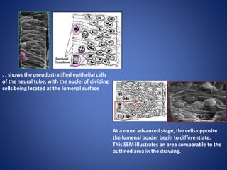. . shows the pseudostratified epithelial cells
of the neural tube, with the nuclei of dividing
cells being located at the lumenal surface
At a more advanced stage, the cells opposite
the lumenal border begin to differentiate.
This SEM illustrates an area comparable to the
outlined area in the drawing.
 