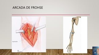 ARCADA DE FROHSE
 