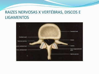 RAIZES NERVOSAS X VERTÉBRAS, DISCOS E
LIGAMENTOS
 