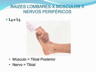  L4 e L5
• Músculo = Tibial Posterior
• Nervo = Tibial
RAIZES LOMBARES X MÚSCULOS X
NERVOS PERIFÉRICOS
 