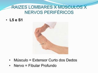 RAIZES LOMBARES X MÚSCULOS X
NERVOS PERIFÉRICOS
• L5 e S1
• Músculo = Extensor Curto dos Dedos
• Nervo = Fibular Profundo
 