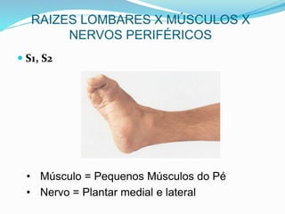  S1, S2
• Músculo = Pequenos Músculos do Pé
• Nervo = Plantar medial e lateral
RAIZES LOMBARES X MÚSCULOS X
NERVOS PERIFÉRICOS
 