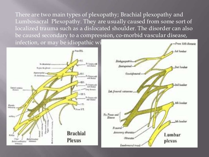 Plexopathy eye nerves diagram 