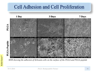 RohitGurav*
Cell Adhesion and Cell Proliferation
30
SEM showing the adhesion of Schwann cells on the surface of the PLGA and PLGA-peptide
PLGA-PeptidePLGA
1 Day 3 Days 7 Days
19-11-2016 PLGA: Biodegradable Polymer
 