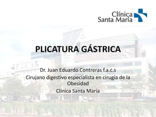 PLICATURA GÁSTRICA Dr. Juan Eduardo Contreras f.a.c.s Cirujano digestivo especialista en cirugía de la Obesidad  Clínica Santa María 