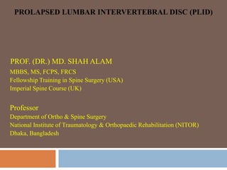 PROLAPSED LUMBAR INTERVERTEBRAL DISC (PLID)
PROF. (DR.) MD. SHAH ALAM
MBBS, MS, FCPS, FRCS
Fellowship Training in Spine Surgery (USA)
Imperial Spine Course (UK)
Professor
Department of Ortho & Spine Surgery
National Institute of Traumatology & Orthopaedic Rehabilitation (NITOR)
Dhaka, Bangladesh
 