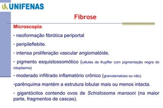 Fibrose   Microscopia :   neoformação fibrótica periportal peripileflebite. intensa proliferação vascular angiomatóide. pigmento esquistossomótico ( células de Kupffer com pigmentação negra do citoplasma)   moderado infiltrado inflamatório crônico ( granulamatoso ou não).  parênquima mantém a estrutura lobular mais ou menos intacta. gigantócitos contendo ovos de  Schistosoma mansoni  (na maior parte, fragmentos de cascas).  