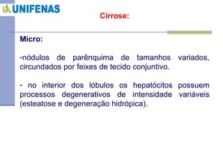 Cirrose: Micro:  nódulos de parênquima de tamanhos variados, circundados por feixes de tecido conjuntivo. no interior dos lóbulos os hepatócitos possuem processos degenerativos de intensidade variáveis (esteatose e degeneração hidrópica).  