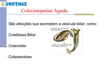 Colecistopatias Aguda São afecções que acometem a vesícula biliar, como: Colelitíase Biliar Colecistite  Colesterolose 