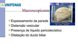 Macroscopicamente Espessamento da parede Distensão vesicular Presença de líquido pericolecístico Dilatação do ducto biliar 