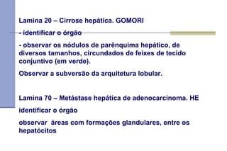 Lamina 20 – Cirrose hepática. GOMORI  - identificar o órgão  - observar os nódulos de parênquima hepático, de diversos tamanhos, circundados de feixes de tecido conjuntivo (em verde). Observar a subversão da arquitetura lobular.  Lamina 70 – Metástase hepática de adenocarcinoma. HE identificar o órgão  observar  áreas com formações glandulares, entre os hepatócitos  