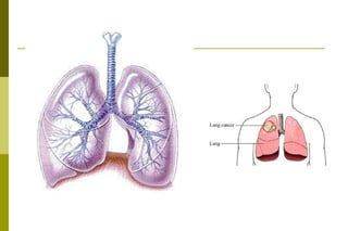 Síndromes Respiratórias PL 03