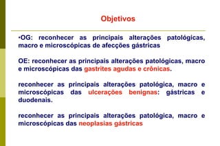 ObjetivosOG: reconhecer as principais alterações patológicas, macro e microscópicas de afecções gástricasOE: reconhecer as principais alterações patológicas, macro e microscópicas das gastrites agudas e crônicas.reconhecer as principais alterações patológica, macro e microscópicas das ulcerações benignas: gástricas e duodenais.reconhecer as principais alterações patológica, macro e microscópicas das neoplasias gástricas  