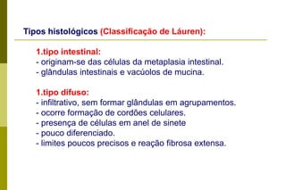  Atinge  mucosa, submucosa, com ou sem acometimento nodal.