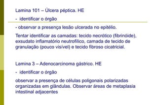  presença de células em anel de sinete