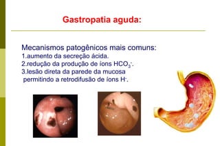 Gastropatia aguda:  Mecanismos patogênicos mais comuns:aumento da secreção ácida. redução da produção de íons HCO3-. lesão direta da parede da mucosa  permitindo a retrodifusão de íons H-.