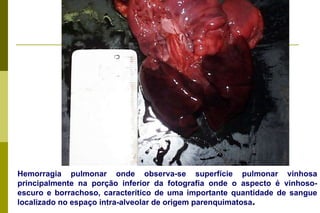 Hemorragia pulmonar onde observa-se superfície pulmonar vinhosa principalmente na porção inferior da fotografia onde o aspecto é vinhoso-escuro e borrachoso, caracterítico de uma importante quantidade de sangue localizado no espaço intra-alveolar de origem parenquimatosa . 