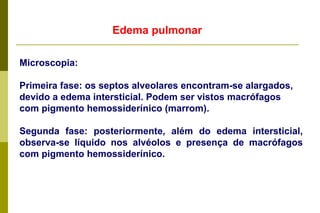 Edema pulmonar Microscopia: Primeira fase: os septos alveolares encontram-se alargados, devido a edema intersticial. Podem ser vistos macrófagos com pigmento hemossiderínico (marrom). Segunda fase: posteriormente, além do edema intersticial, observa-se líquido nos alvéolos e presença de macrófagos com pigmento hemossiderínico. 