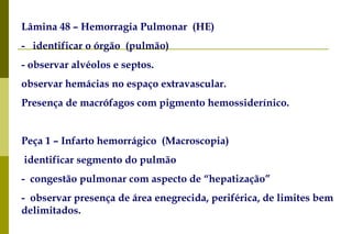 Lâmina 48 – Hemorragia Pulmonar  (HE)  -     identificar o órgão  (pulmão) -   observar alvéolos e septos. observar hemácias no espaço extravascular.  Presença de macrófagos com pigmento hemossiderínico. Peça 1 – Infarto hemorrágico  (Macroscopia) identificar segmento do pulmão -    congestão pulmonar com aspecto de “hepatização” -    observar presença de área enegrecida, periférica, de limites bem delimitados. 
