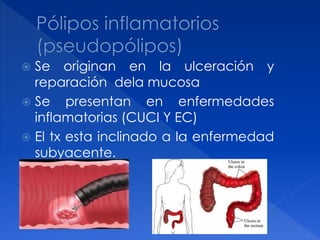  Se originan en la ulceración y
reparación dela mucosa
 Se presentan en enfermedades
inflamatorias (CUCI Y EC)
 El tx esta inclinado a la enfermedad
subyacente.
 