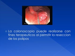  La colonoscopia puede realizarse con
fines terapeuticos al permitir la reseccion
de los polipos
 