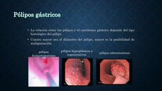 • La relación entre los pólipos y el carcinoma gástrico depende del tipo
histológico del pólipo
• Cuanto mayor sea el diámetro del pólipo, mayor es la posibilidad de
malignización.
pólipos
hamartomatosos
pólipos hiperplásicos o
regenerativos
pólipos adenomatosos
 