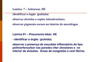 Lamina  7 – Antracose. HE  identificar o órgão  (pulmão) observar alvéolos e septos interalveolares. observar pigmento escuro no interior de macrófagos Lamina 81 – Pneumonia lobar. HE  - identificar o órgão  (pulmão) observar a presença de exsudato inflamatório do tipo polimorfonuclear nas paredes inter alveolares e  no interior de alvéolos.  Áreas de congestão e com fibrina.  