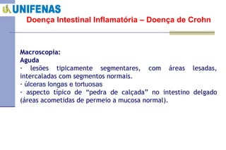 Doença Intestinal Inflamatória – Doença de Crohn Macroscopia:  Aguda lesões tipicamente segmentares, com áreas lesadas, intercaladas com segmentos normais.  ú lceras longas e tortuosas  aspecto típico de “pedra de calçada” no intestino delgado (áreas acometidas de permeio a mucosa normal). 