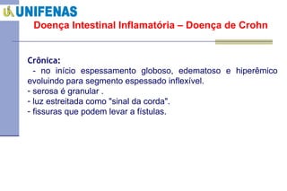 Doença Intestinal Inflamatória – Doença de Crohn Crônica: - no início espessamento globoso, edematoso e hiperêmico evoluindo para segmento espessado inflexível. serosa é granular . luz estreitada como "sinal da corda". fissuras que podem levar a fístulas. 