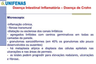 Doença Intestinal Inflamatória – Doença de Crohn Microscopia:  inflamação crônica, fibrose transmural dilatação ou esclerose dos canais linfáticos  agregados linfóides com centros germinativos em todas as camadas da parede. granulomas sarcoidiformes (em 40% os granulomas são pouco desenvolvidos ou ausentes) há metaplasia atípica e displasia das células epiteliais nas ulcerações e nas áreas de permeio. -  as lesões podem progredir para elevações nodulares, ulcerações e fibrose .   
