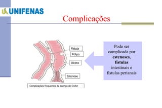 Complicações Fístula Pólipo Estenose Úlcera Complicações frequentes da doença de Crohn Pode ser complicada por  estenoses ,  fístulas  intestinais e fístulas perianais 