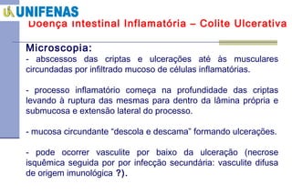 Doença Intestinal Inflamatória – Colite Ulcerativa Microscopia: abscessos das criptas e ulcerações até às musculares circundadas por infiltrado mucoso de células inflamatórias. processo inflamatório começa na profundidade das criptas levando à ruptura das mesmas para dentro da lâmina própria e submucosa e extensão lateral do processo. mucosa circundante “descola e descama” formando ulcerações. pode ocorrer vasculite por baixo da ulceração (necrose isquêmica seguida por por infecção secundária: vasculite difusa de origem imunológica  ?). 