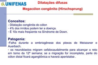 Dilatações difusas Megacólon congênito (Hirschsprung) Conceitos: - Dilatação congênita do cólon  4% dos irmãos podem ter a doença. É 10x mais freqüente na Síndrome de Down. Patogenia: Falha durante a embriogênese dos plexos de Meisssner e Auerbach. os neuroblastos migram cefalocaudalmente para alcançar o reto em torno da 12ª semana; se a migração for incompleta, parte do cólon distal ficará agangliônica e haverá aperistalse . 